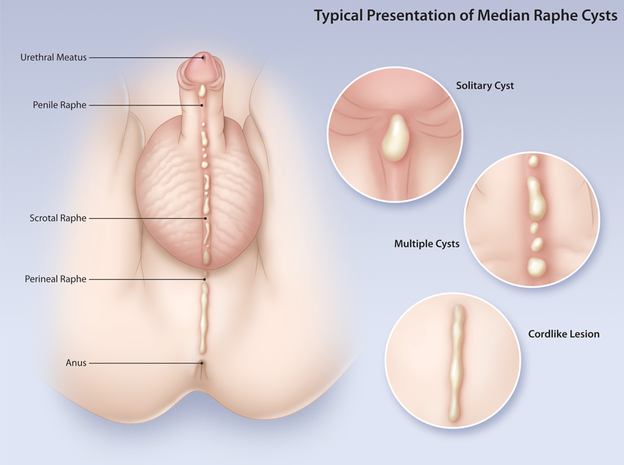 Common anorectal problems