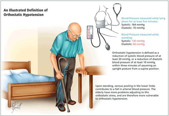 Orthostatic hypotension blood pressure measurement illustration